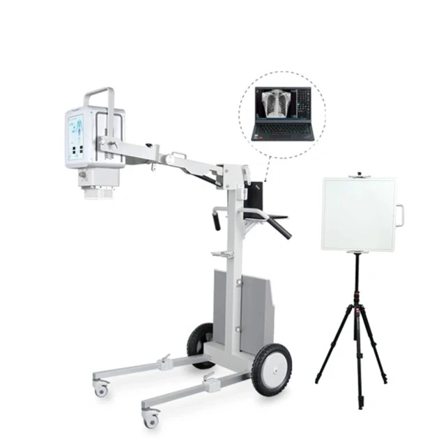 Mobile X Ray Bucky Stand