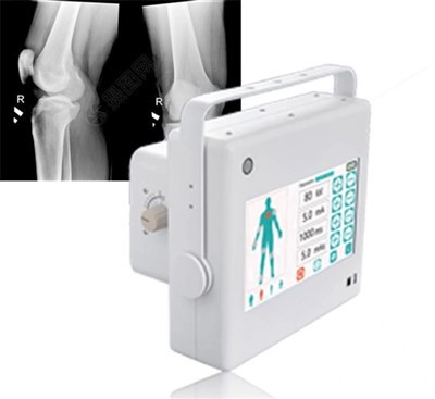 Ftlf 10 1 KW prijenosni xray stroj
